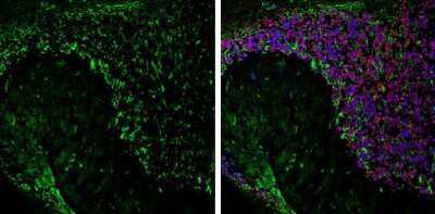 Immunohistochemistry-Frozen: Aquaporin-4 Antibody [NBP3-12902]