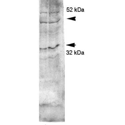 Western Blot: Aquaporin-4 Antibody [NBP1-97928]