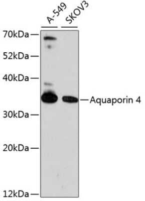 Western Blot: Aquaporin-4 AntibodyAzide and BSA Free [NBP2-92730]