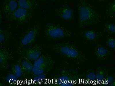 Immunocytochemistry/ Immunofluorescence: Aquaporin-5 Antibody - BSA Free [NBP2-67247]