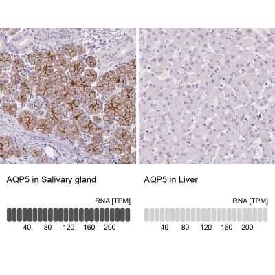 Immunohistochemistry-Paraffin: Aquaporin-5 Antibody [NBP2-39043]