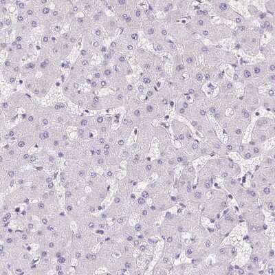 Immunohistochemistry-Paraffin: Aquaporin-5 Antibody [NBP2-39043]