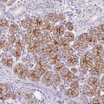 Immunohistochemistry-Paraffin: Aquaporin-5 Antibody [NBP2-39043]