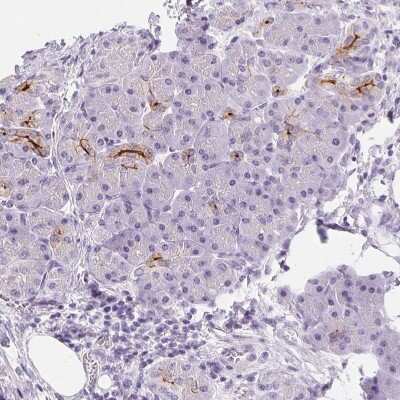 Immunohistochemistry-Paraffin: Aquaporin-5 Antibody [NBP2-39043]