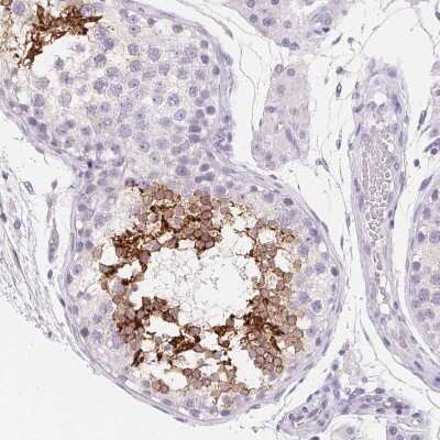 Immunohistochemistry-Paraffin: Aquaporin-5 Antibody [NBP2-39043]