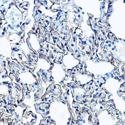 Immunohistochemistry-Paraffin: Aquaporin-5 Antibody - Azide and BSA Free [NBP3-02963]