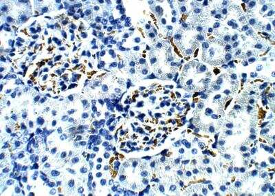 Immunohistochemistry-Paraffin: Aquaporin-5 Antibody [NBP3-12286]