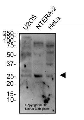 Western Blot: Aquaporin-5 AntibodyBSA Free [NBP2-67247]