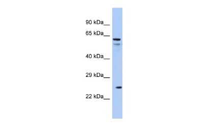 Western Blot: Aquaporin-5 Antibody [NBP2-84445]