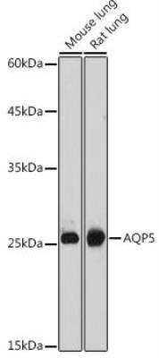 Western Blot: Aquaporin-5 AntibodyAzide and BSA Free [NBP2-92926]