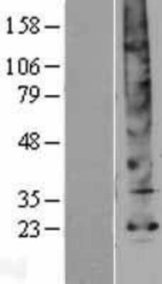 Western Blot: Aquaporin-5 Overexpression Lysate [NBP2-04201]