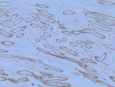 Immunohistochemistry-Paraffin: Aquaporin-6 Antibody [NBP1-90119]