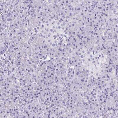 Immunohistochemistry-Paraffin: Aquaporin-6 Antibody [NBP1-90119]