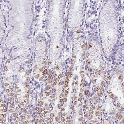 Immunohistochemistry-Paraffin: Aquaporin-6 Antibody [NBP1-90119]
