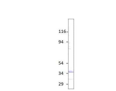 Western Blot: Aquaporin-6 Antibody [NBP3-12380]