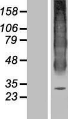 Western Blot: Aquaporin-6 Overexpression Lysate [NBP2-10980]