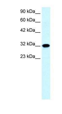 Western Blot: Aquaporin-7 Antibody [NBP1-54384]