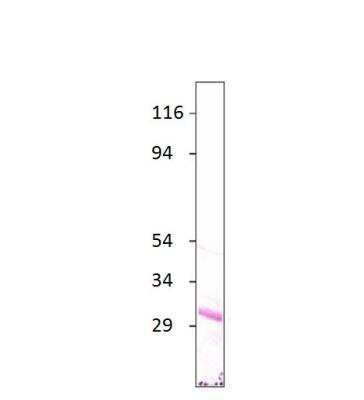 Western Blot: Aquaporin-7 Antibody [NBP3-12434]