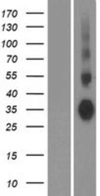 Western Blot: Aquaporin-7 Overexpression Lysate [NBP2-10958]