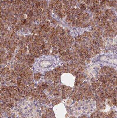 Immunohistochemistry-Paraffin: Aquaporin-8 Antibody [NBP1-91676]