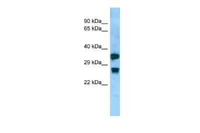 Western Blot: Aquaporin-8 Antibody [NBP3-10585]