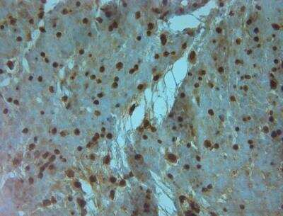 Immunohistochemistry-Paraffin: Aquaporin-9 Antibody [NBP1-30865]