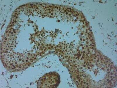 Immunohistochemistry-Paraffin: Aquaporin-9 Antibody [NBP1-30865]