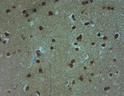 Immunohistochemistry-Paraffin: Aquaporin-9 Antibody [NBP1-30865]