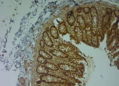 Immunohistochemistry-Paraffin: Aquaporin-9 Antibody [NBP1-30865]