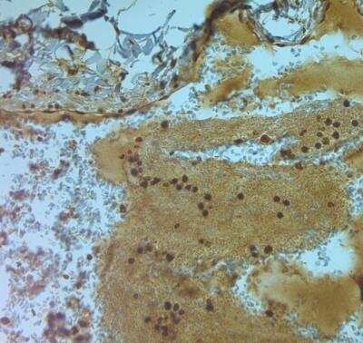 Immunohistochemistry-Paraffin: Aquaporin-9 Antibody [NBP1-30865]