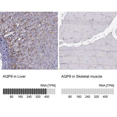 Immunohistochemistry-Paraffin: Aquaporin-9 Antibody [NBP2-62691]