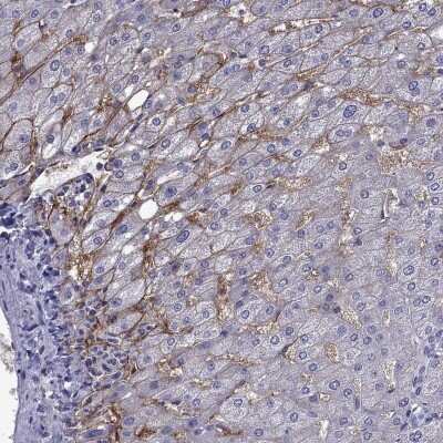 Immunohistochemistry-Paraffin: Aquaporin-9 Antibody [NBP2-62691]