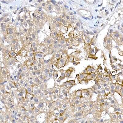 Immunohistochemistry-Paraffin: Aquaporin-9 Antibody - BSA Free [NBP2-92558]