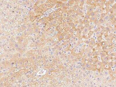 Immunohistochemistry-Paraffin: Aquaporin-9 Antibody [NBP2-99492]