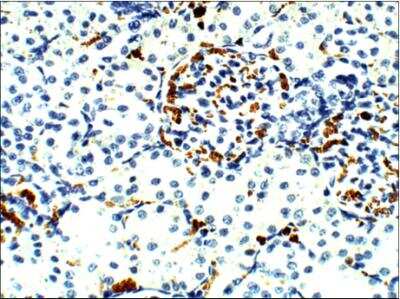 Immunohistochemistry-Paraffin: Aquaporin-9 Antibody [NBP3-12260]