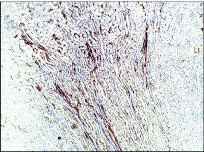 Immunohistochemistry-Paraffin: Aquaporin-9 Antibody [NBP3-12260]