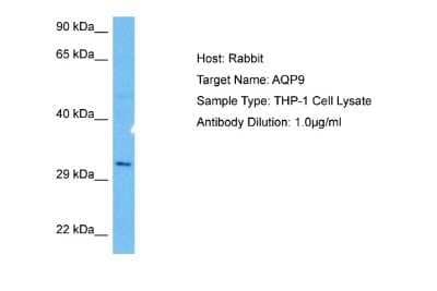 Western Blot: Aquaporin-9 Antibody [NBP2-84446]