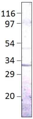 Western Blot: Aquaporin-9 Antibody [NBP3-12260]