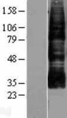 Western Blot: Aquaporin-9 Overexpression Lysate [NBL1-07642]