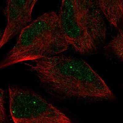 Immunocytochemistry/ Immunofluorescence: Archaemetzincin 2 Antibody [NBP2-56224]