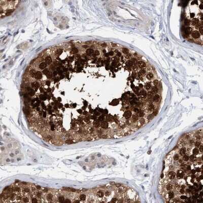Immunohistochemistry-Paraffin: Archaemetzincin 2 Antibody [NBP1-85996]