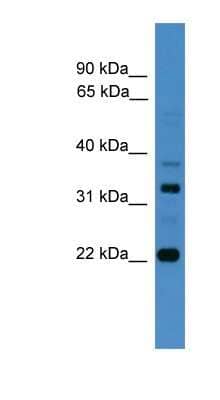 Western Blot: Archaemetzincin 2 Antibody [NBP1-79621]