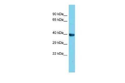 Western Blot: Archaemetzincin 2 Antibody [NBP3-10636]