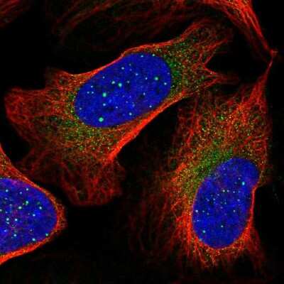 Immunocytochemistry/ Immunofluorescence: ArgRS Antibody [NBP2-31923]