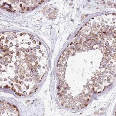 Immunohistochemistry: ArgRS Antibody [NBP2-31923]