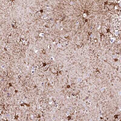 Immunohistochemistry: ArgRS Antibody [NBP2-31978]