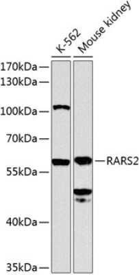 Western Blot: ArgRS AntibodyBSA Free [NBP2-92835]