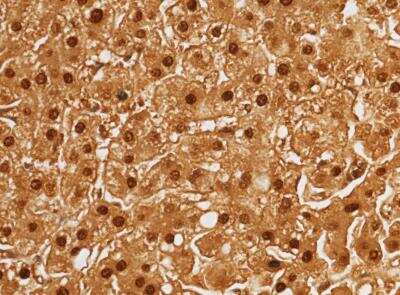 Immunohistochemistry-Paraffin: Arginase 1/ARG1/liver Arginase Antibody (034) [NBP2-89915]
