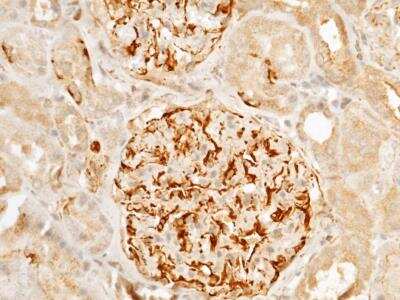 Immunohistochemistry-Paraffin: Arginase 1/ARG1/liver Arginase Antibody (034) [NBP2-89915]