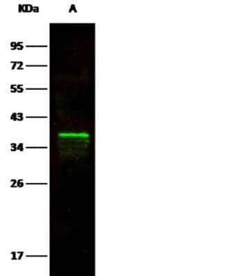 Western Blot: Arginase 1/ARG1/liver Arginase Antibody (034) [NBP2-89915]